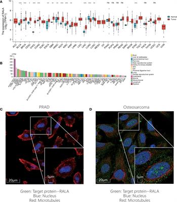 Systematic pan-cancer analysis identifies RALA as a tumor targeting immune therapeutic and prognostic marker